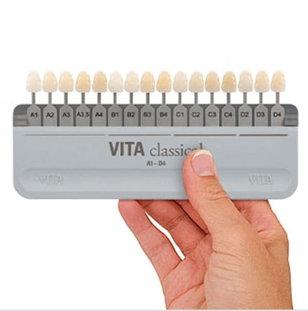 Zahnfarbbestimmung – VITA Zahnfabrik H. Rauter, Diagnostics