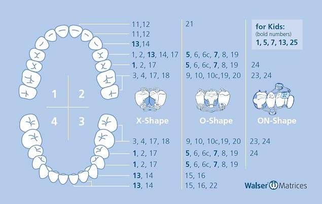 Walser Sectional Matrix System Sets – Dr. Walser Dental, Matrices & Matrix Systems