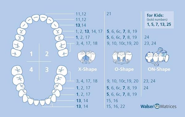 Walser Sectional Matrix System Sets