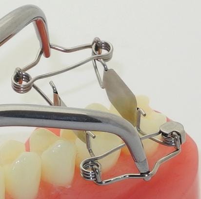 New tooth matrices for one-sided deep caries