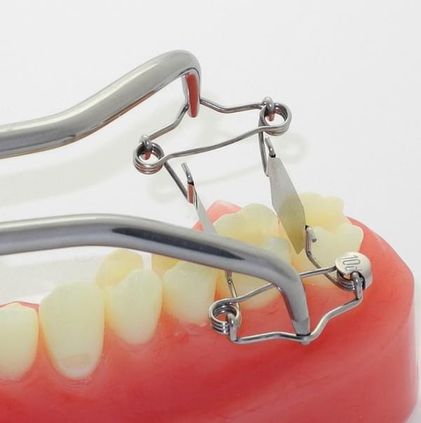 New tooth matrix for extra deep caries on one side