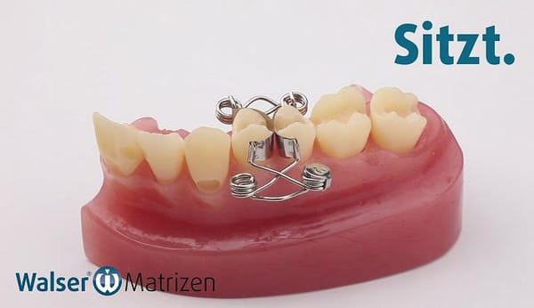 Walser® Dental Matrix for biplane fillings