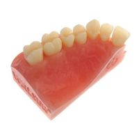 Walser model – Dr. Walser Dental, Matrices & Matrix Systems