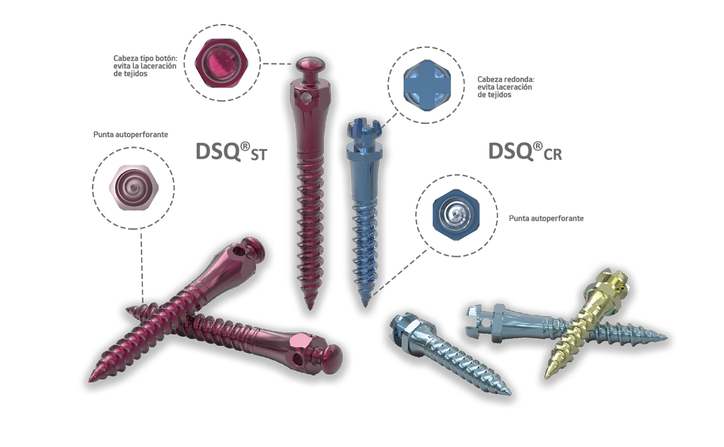 Los microimplantes DSQ para tratamientos de ortodoncia