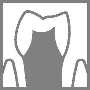 Crown preparation