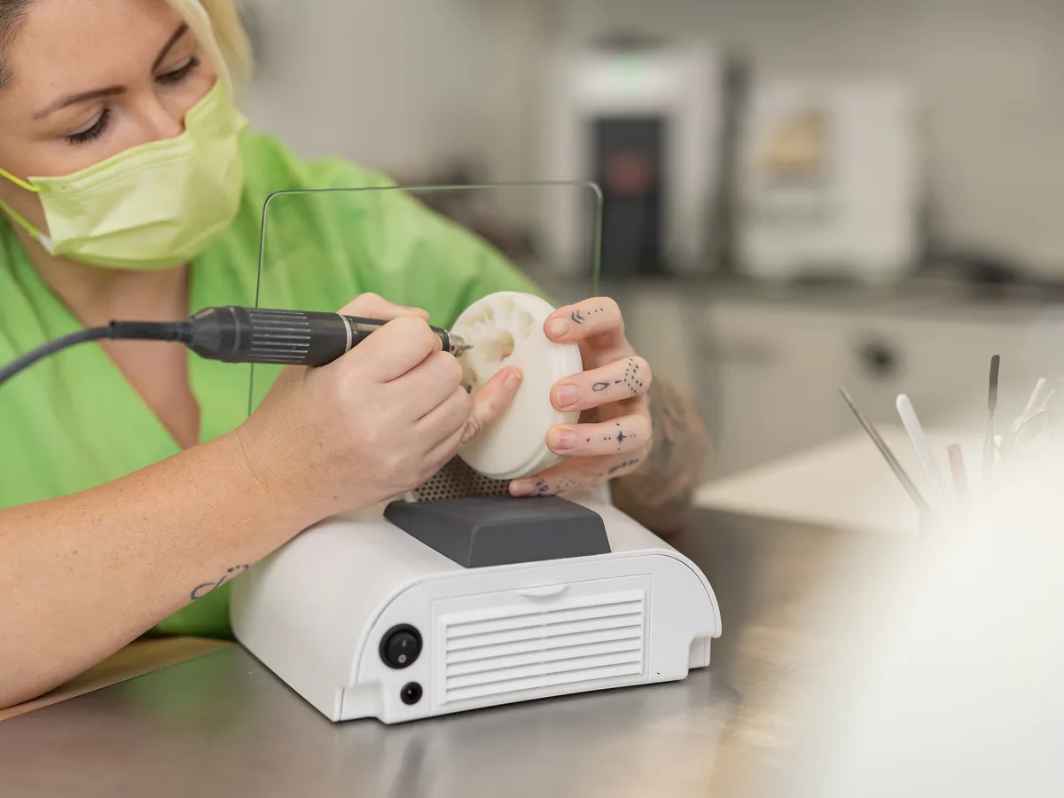 CEREC-Nacharbeit